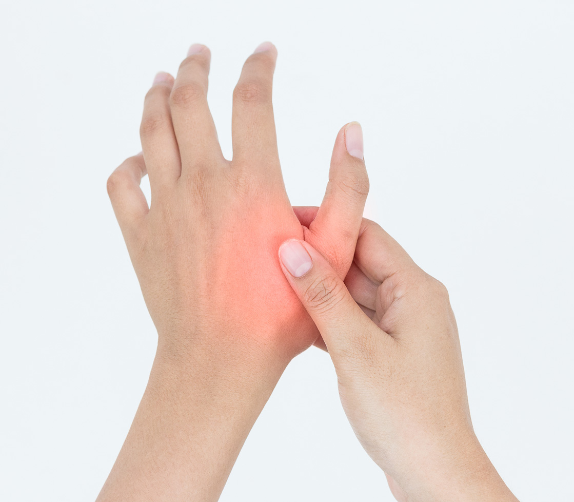 Woman's hands showing CMC thumb pain