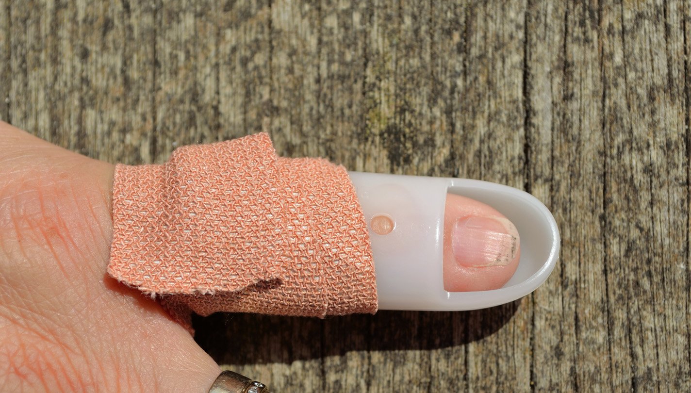 Finger splinted with a stax splint.