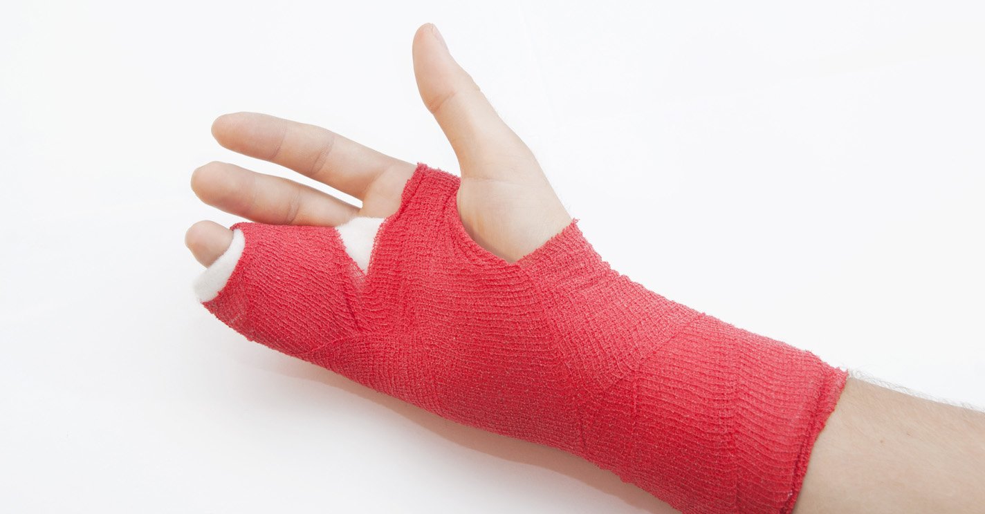 A hand and wrist in an ulnar gutter cast.