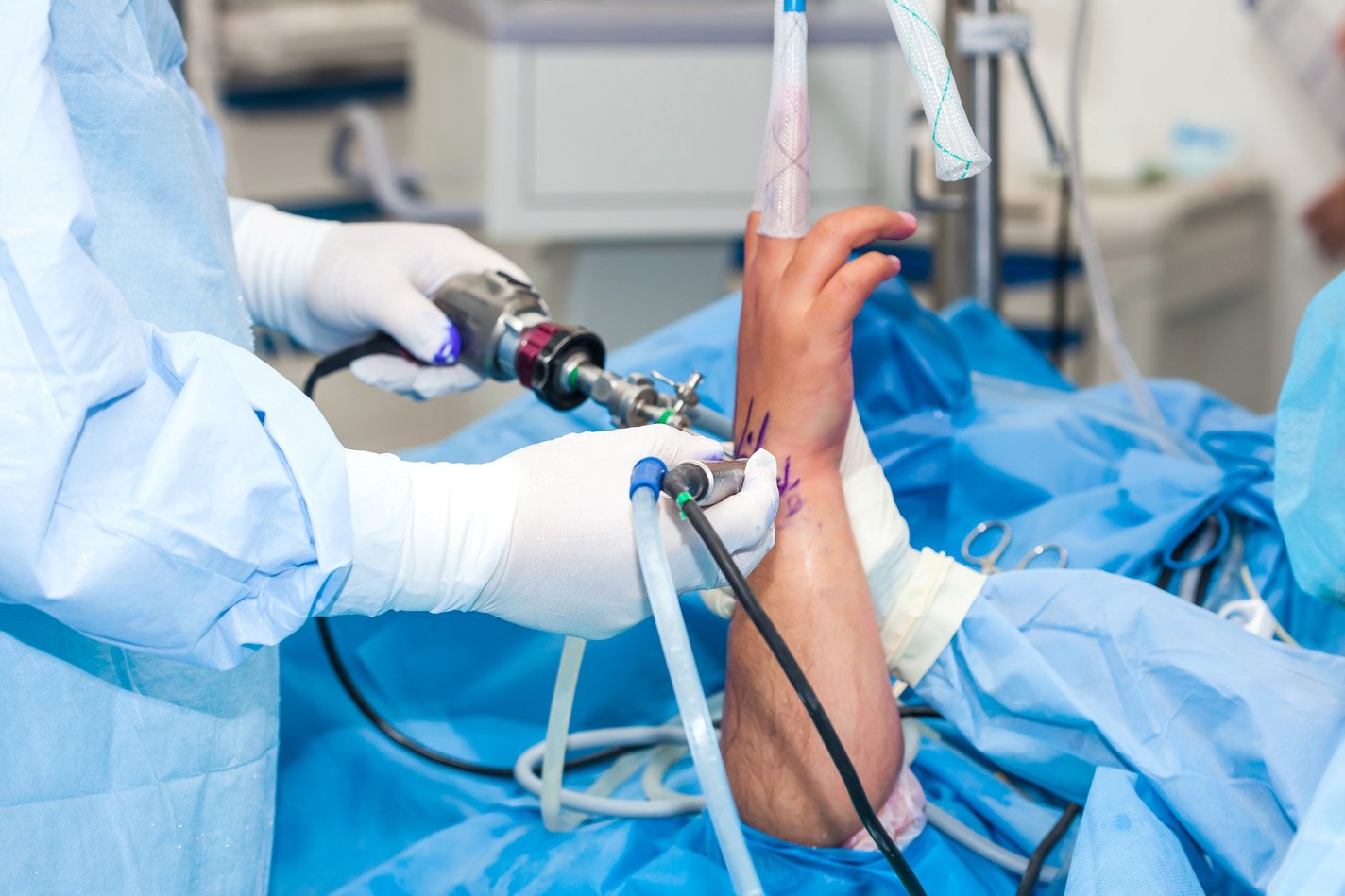 Wrist Arthroscopy being performed in the surgical suite.